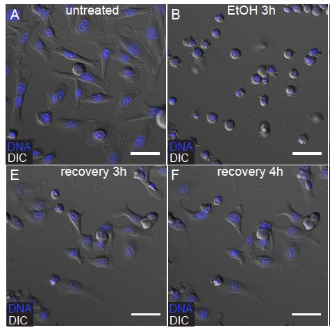 Human cells prior to treatment (A), the same group of cells after a 3 hour exposure to EtOH which induces apoptosis (B), and the same field of cells after 3 or 4 hours of recovery. DNA is stained in blue. the cells shrivel up when they undergo apoptosis and the spread out again when they recover.