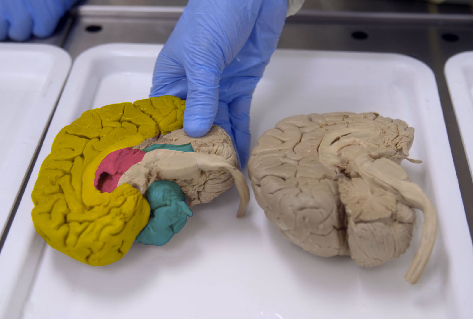 we-dissected-a-brain-to-understand-what-happens-when-you-die-vice