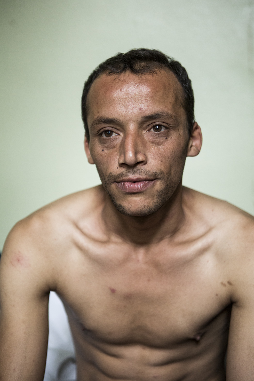 Sofian kommt aus Nordafrika, er hat eine langjährige Odysee durch viele Länder Europas hinter sich. Sein Körper ist übersäht mit Narben - sie stammen nicht aus dem Krieg, sondern sind Spuren von europäischer Polizeigewalt. Foto: Florian Büttner