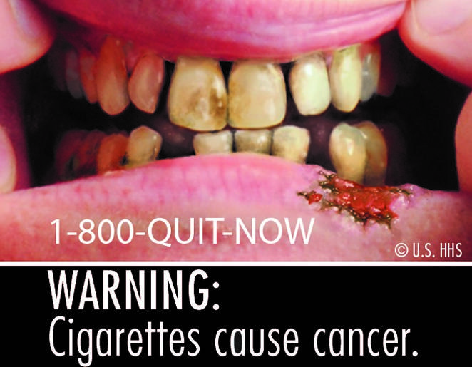 graphic-anti-smoking-signs-may-actually-encourage-some-teens-to-smoke-vice