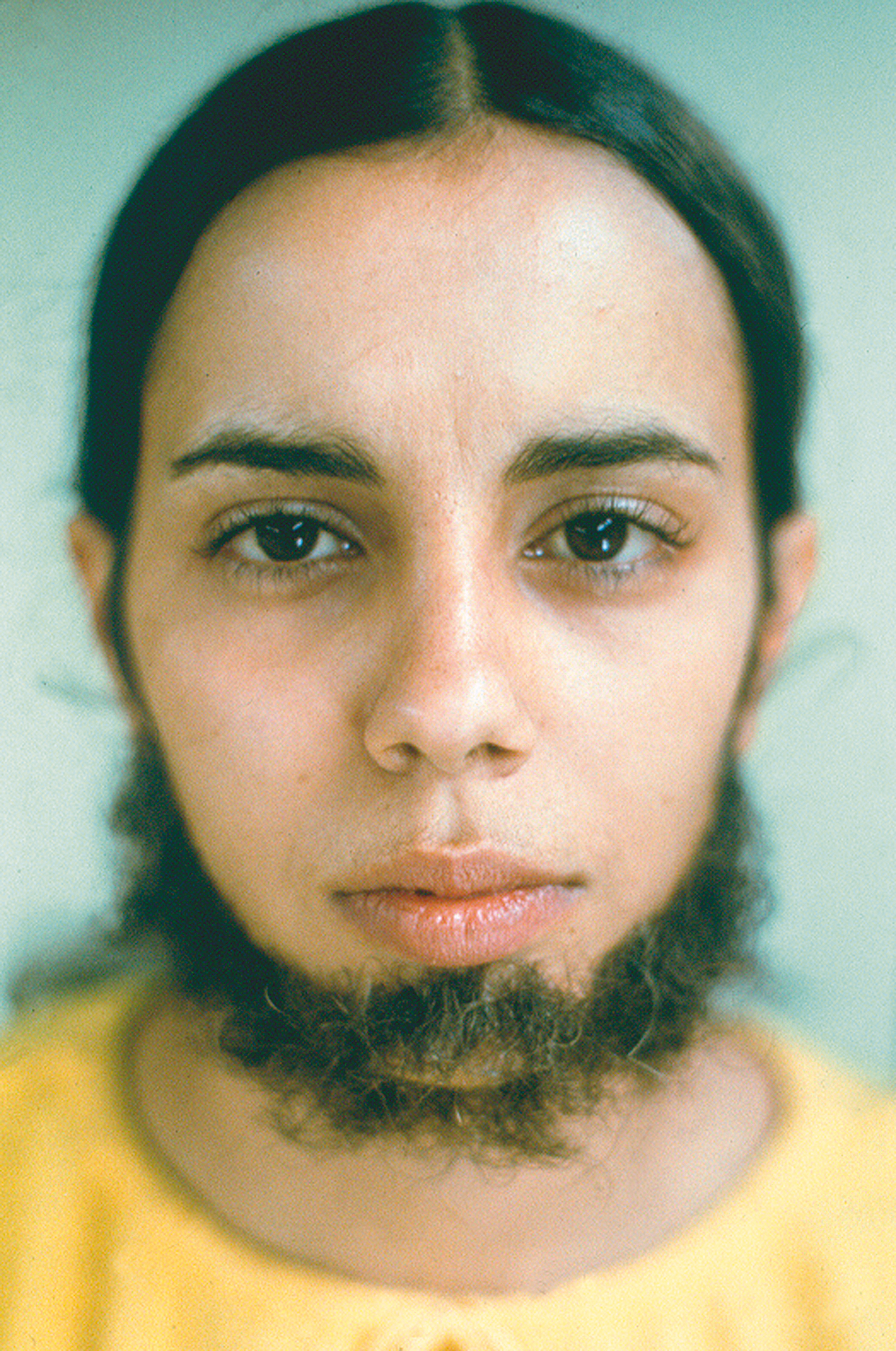 Ana Mendieta Fought For Womens Rights And Paid With Blood