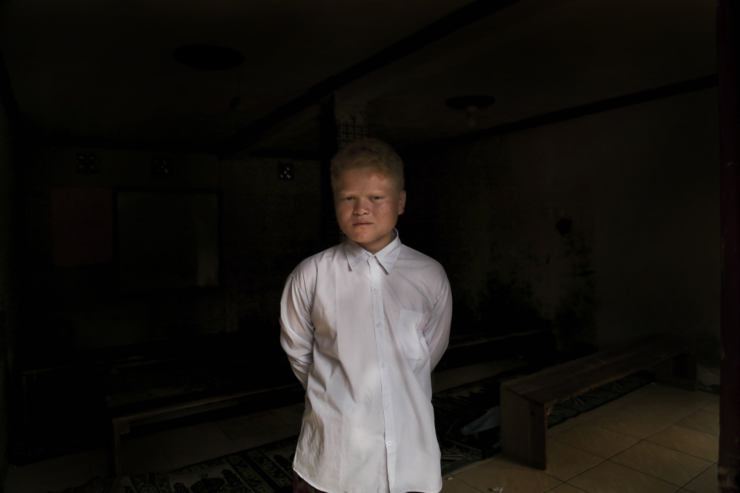 Portraits of People Living with Albinism in a Remote Village in