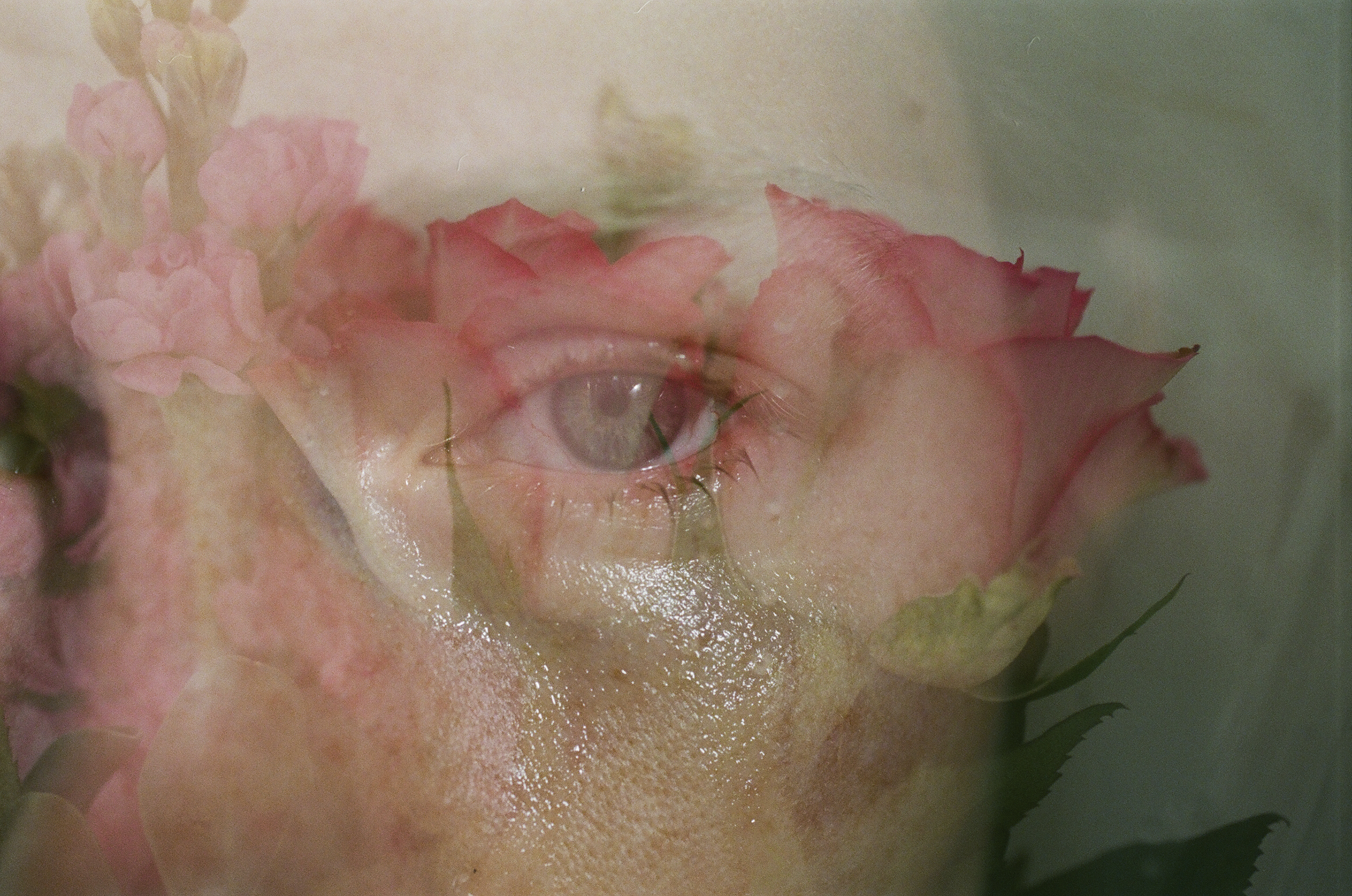lina-scheynius