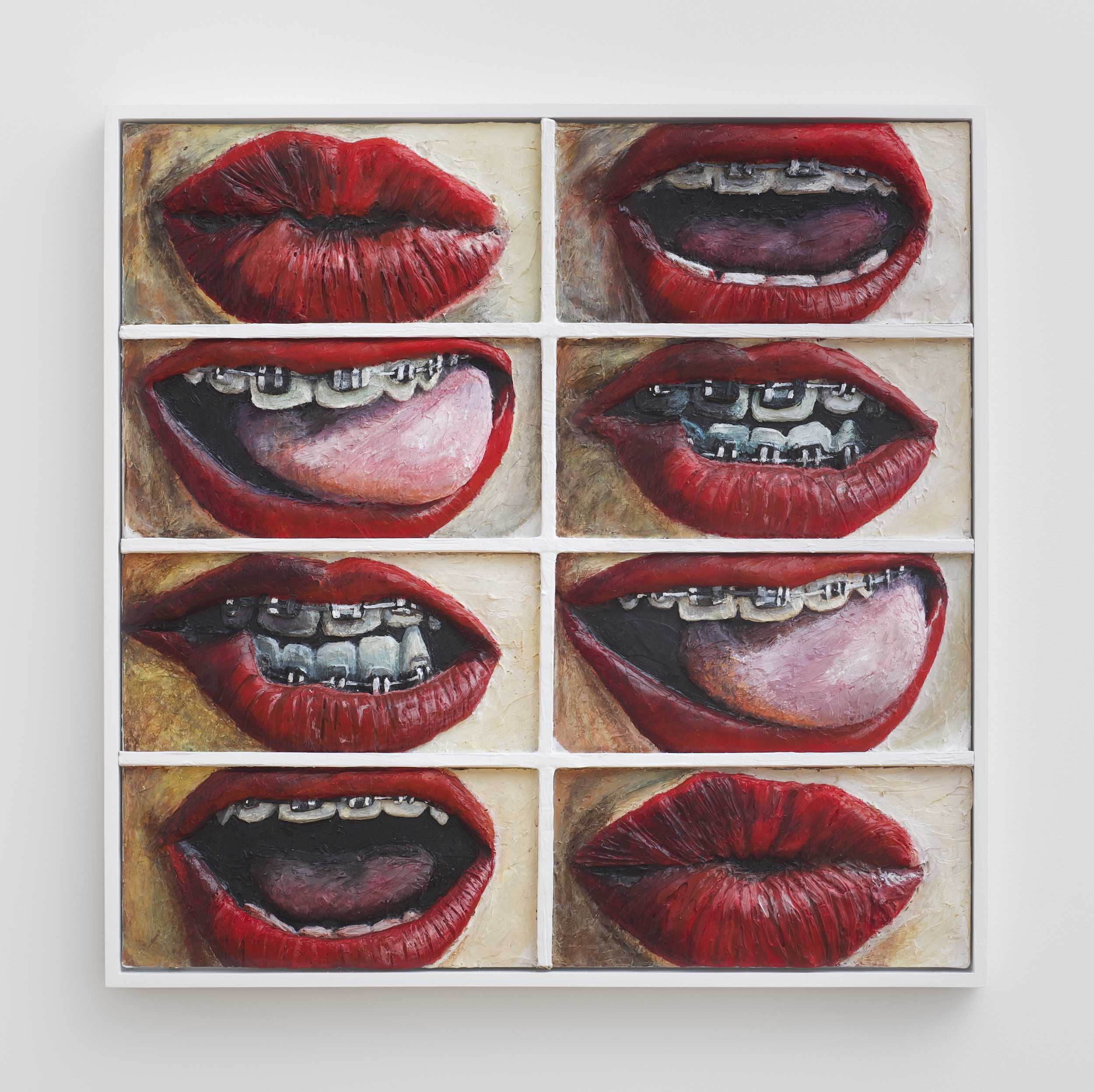 1553100550040-Who_Has_Braces-copy