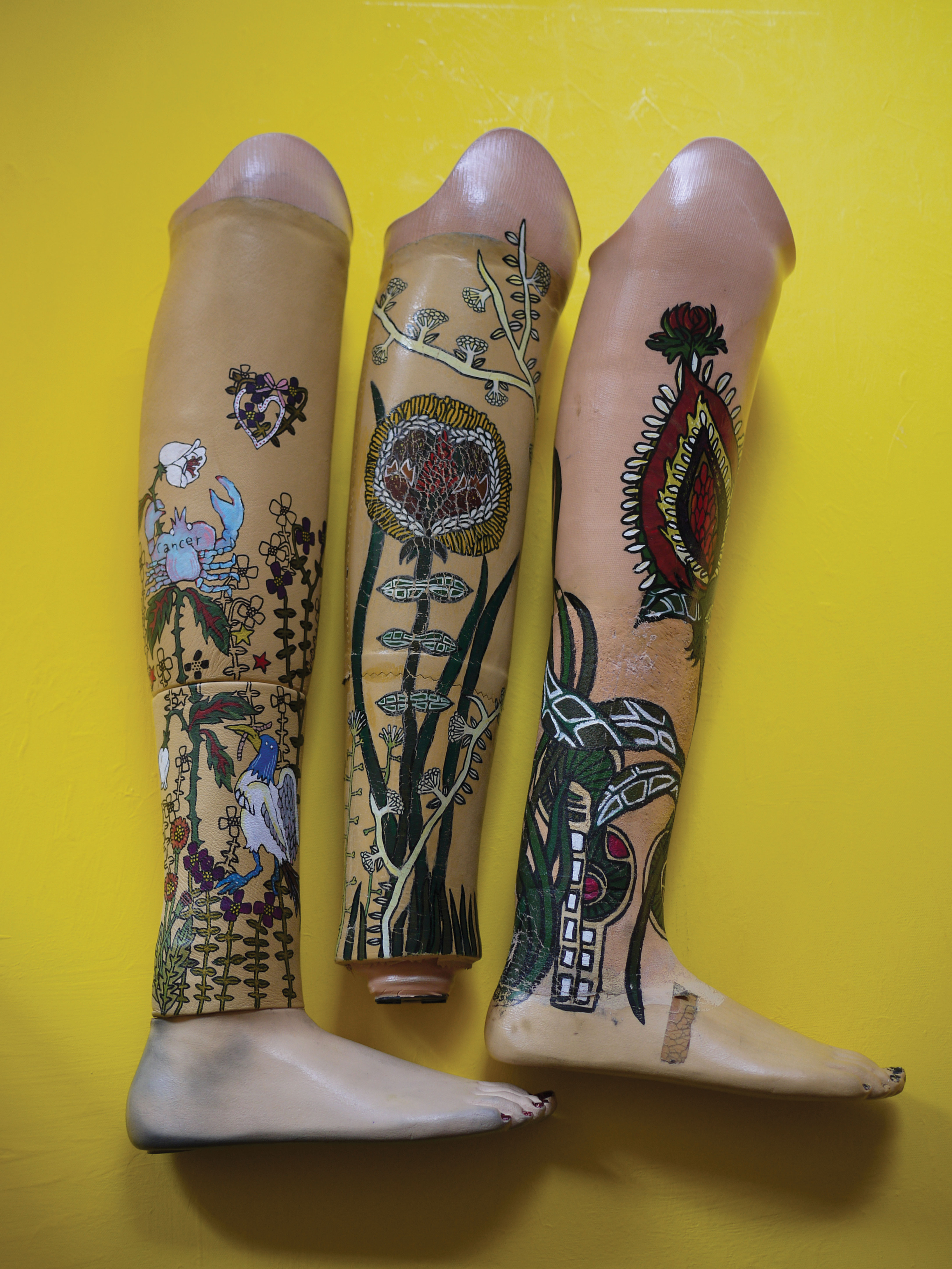 1556217617646-2005_mylegs