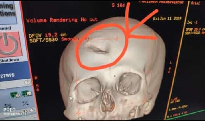 India doctor attacked