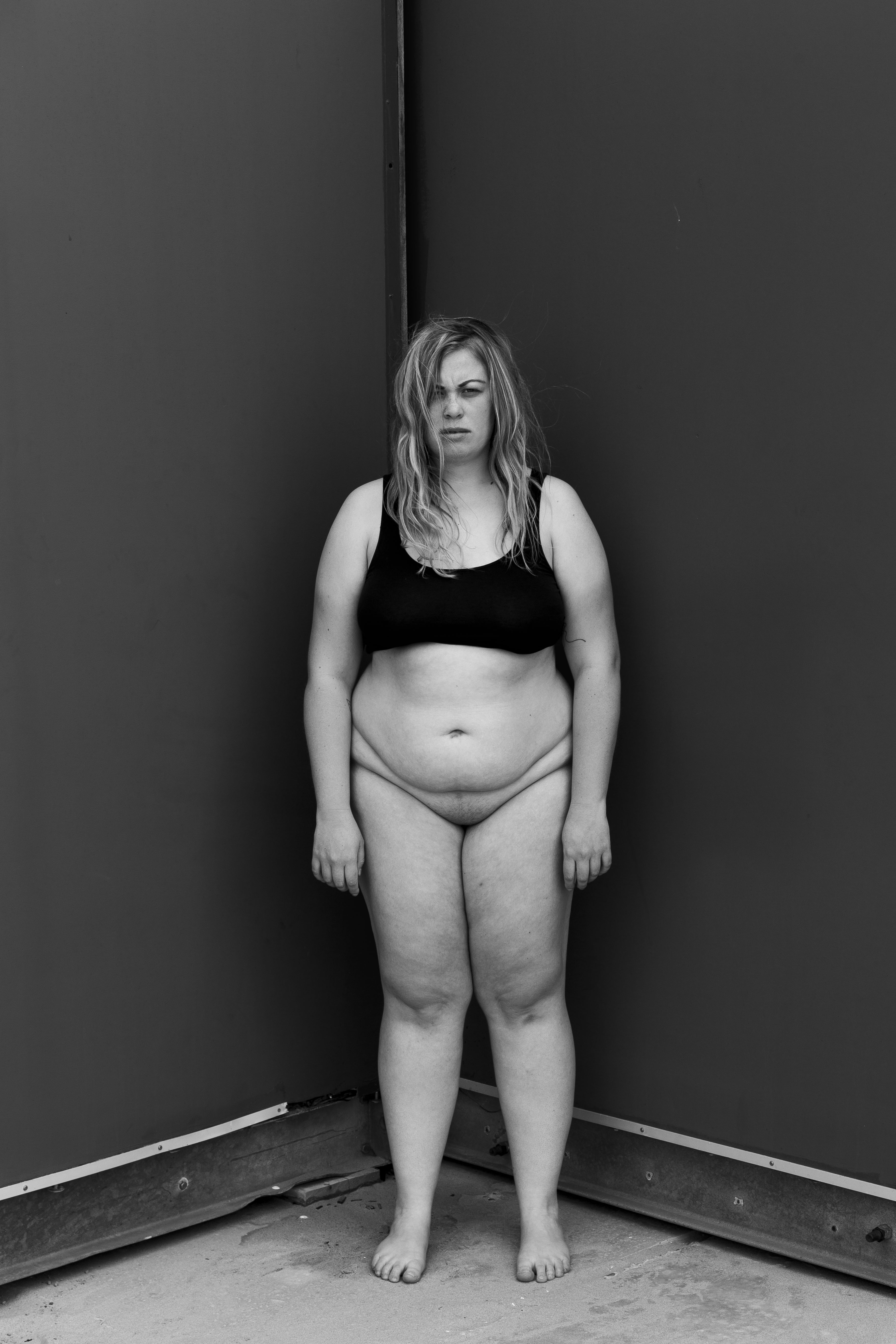 People With Obesity Naked