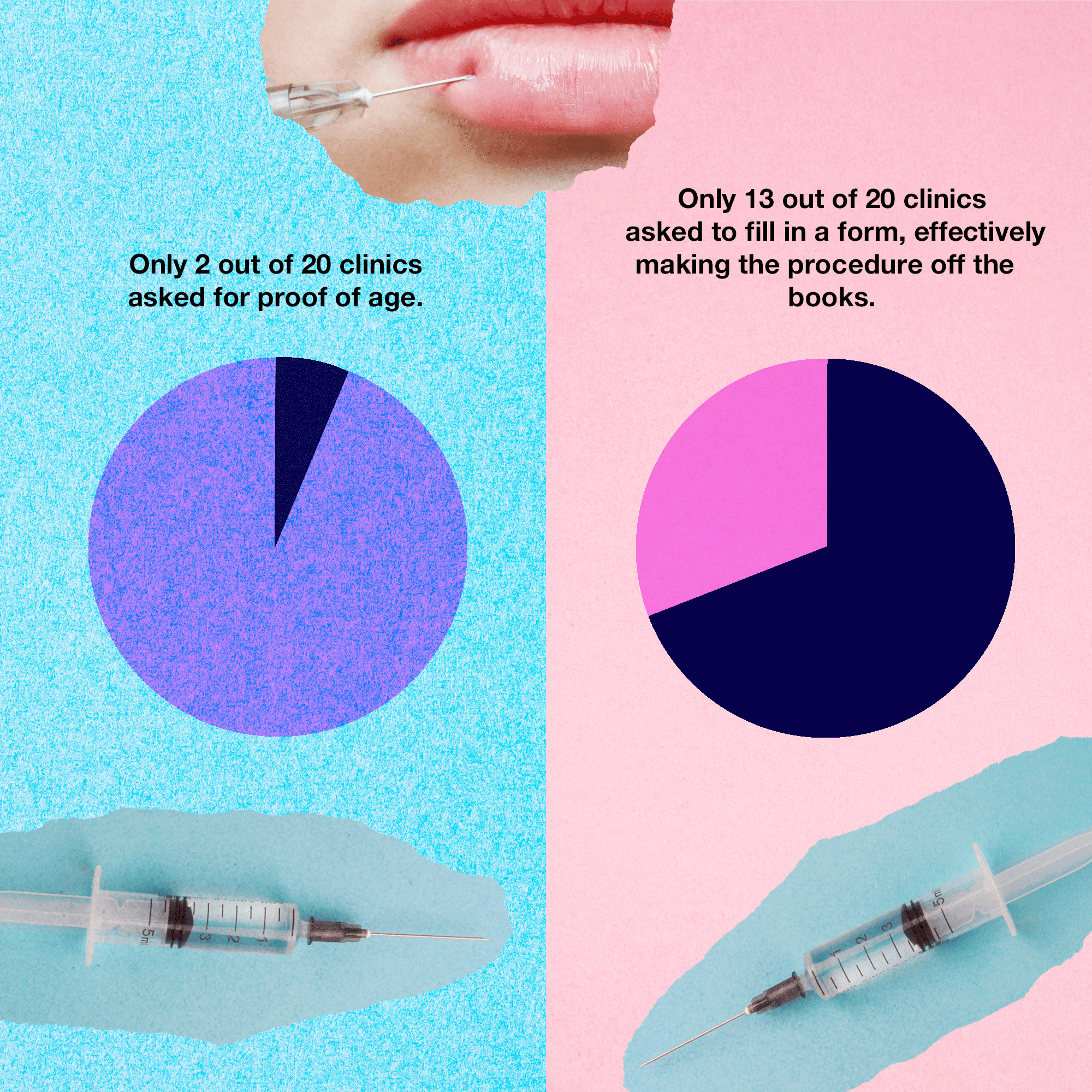 lip fillers uk