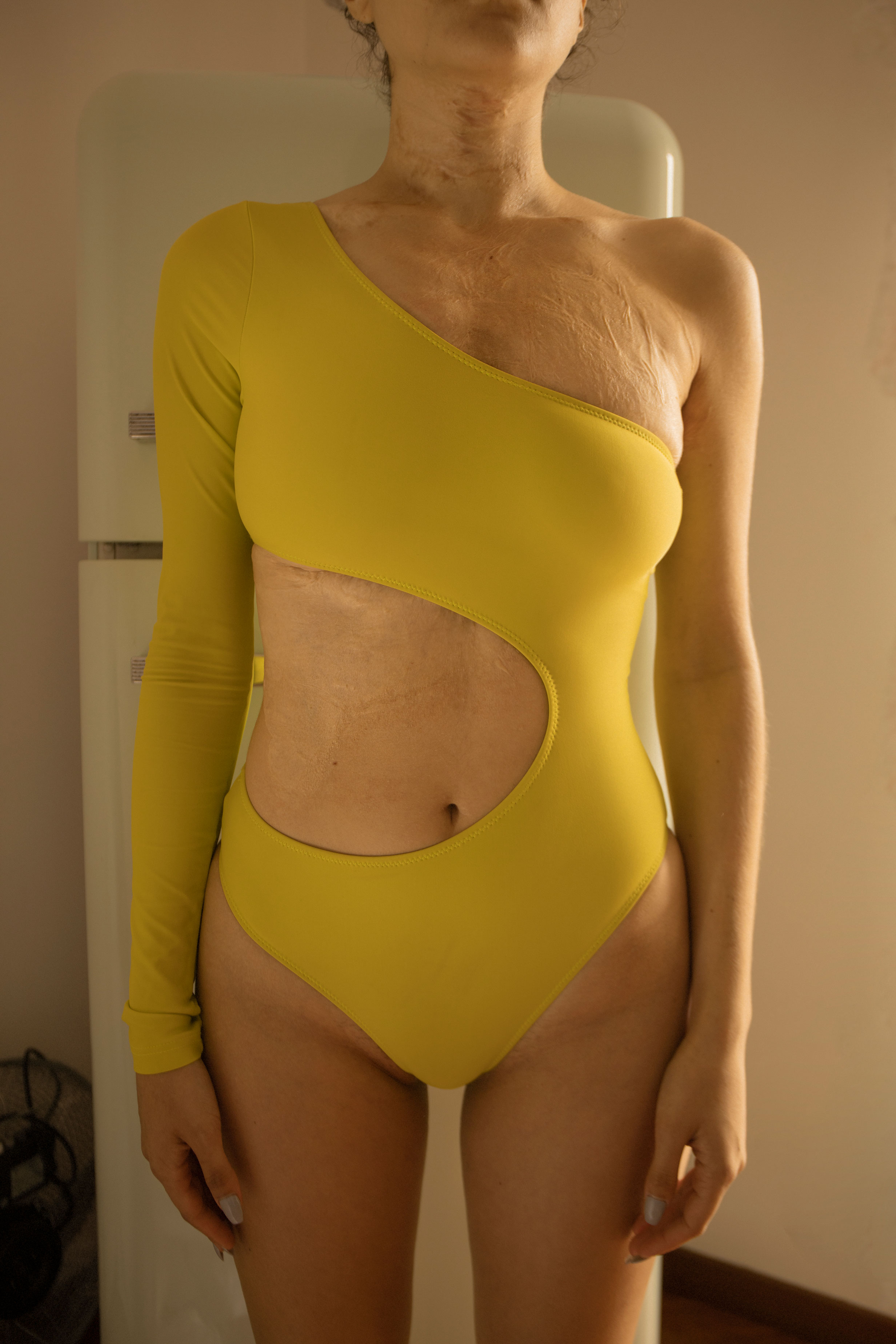 body_positivity_fotografia_hawa_a_najjar_cicatrici_stereotipi_bellezza