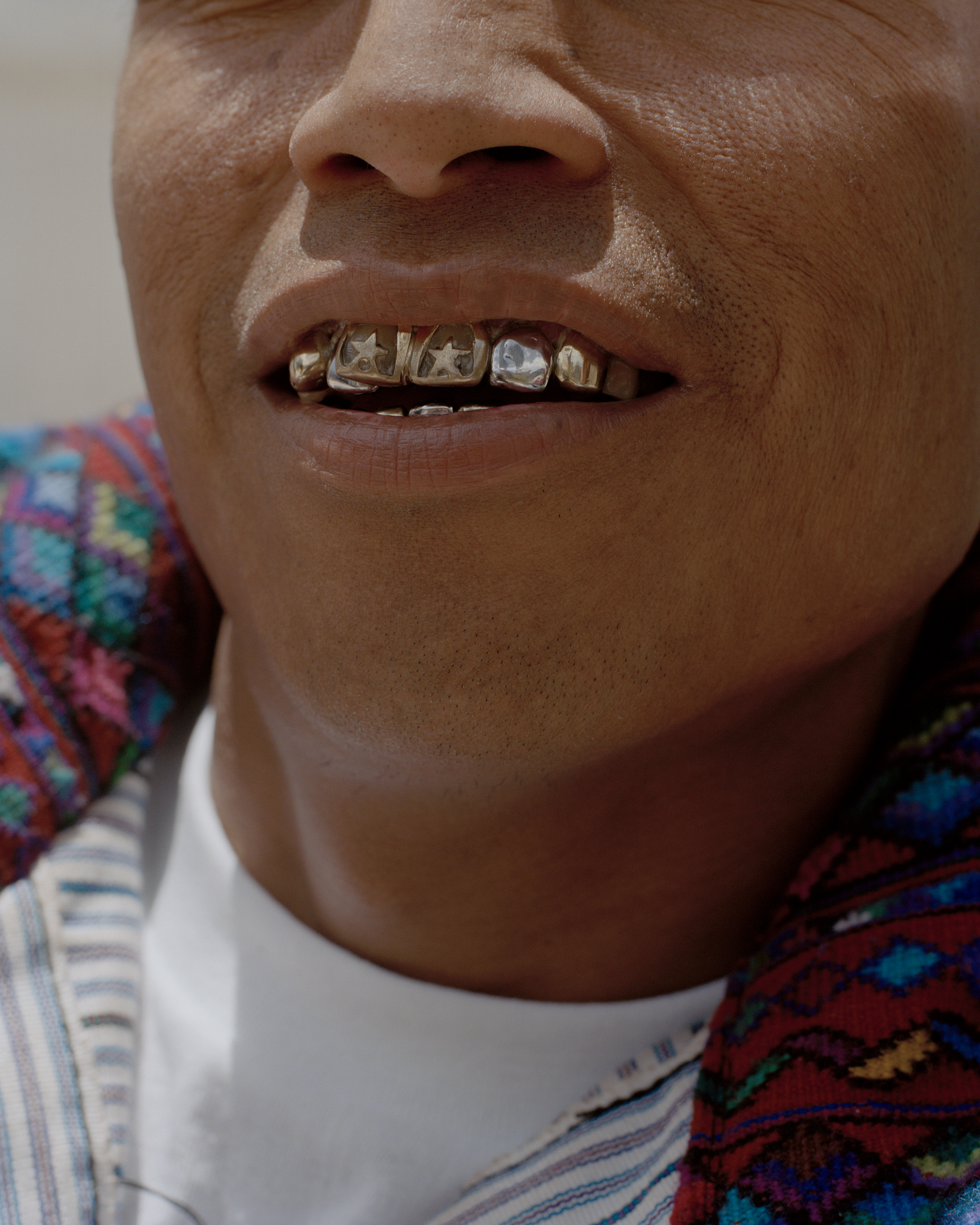 image of gold teeth