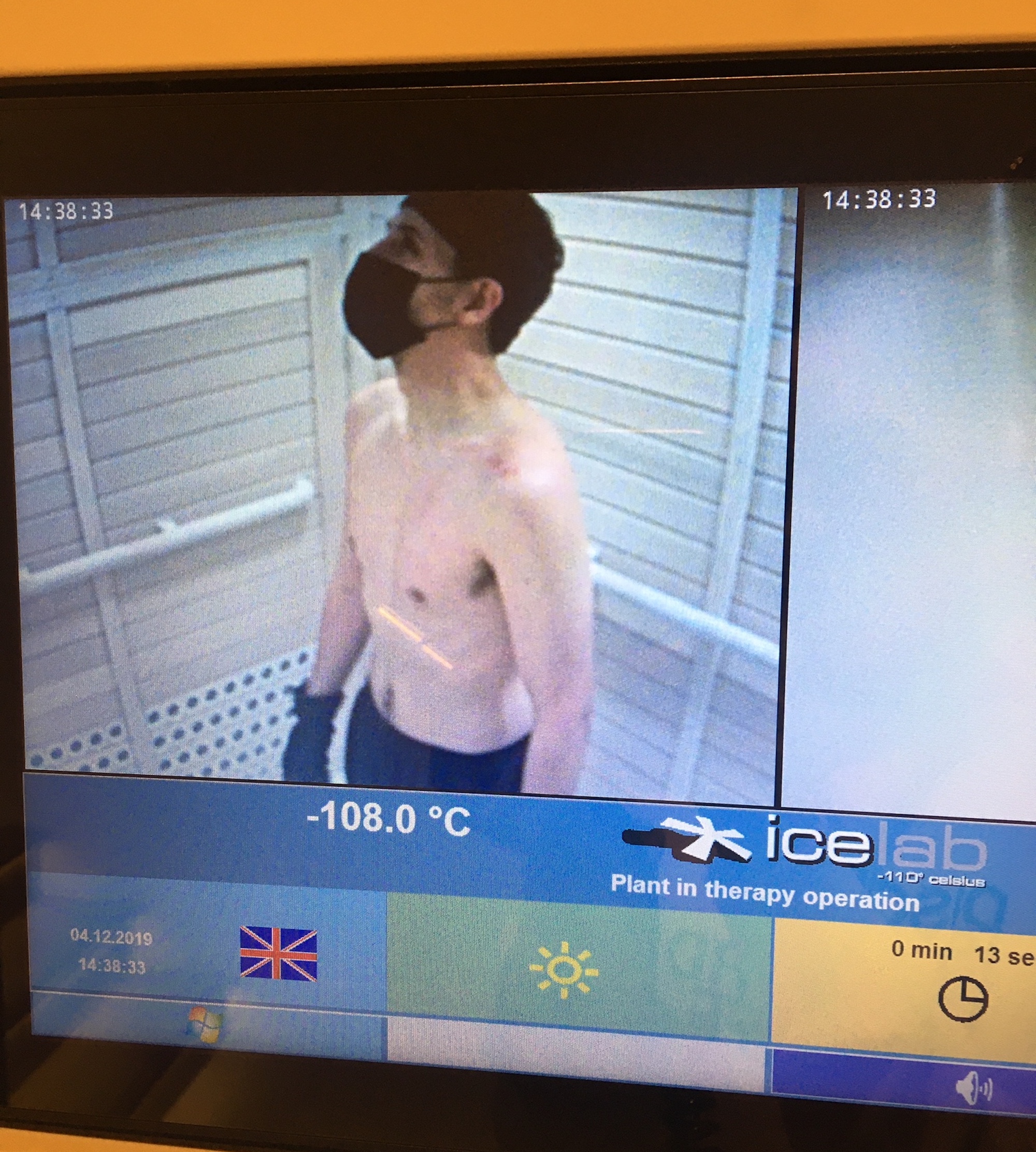 cryotherapy london
