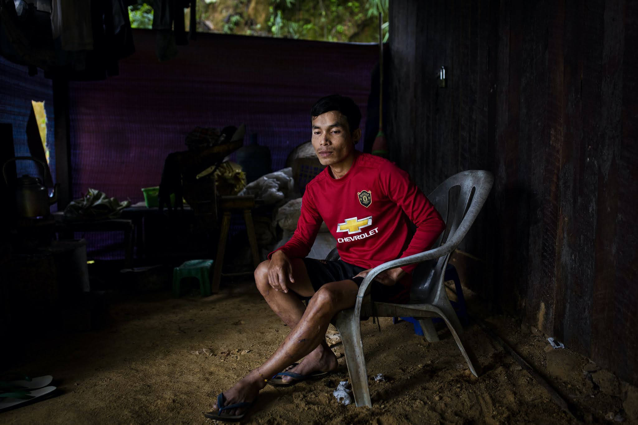 Bo Kyaw Thant, a 21-year-old freelance miner, sits in his house. He survived the July 2 landslide in Gwi Hka mine in Hpakant, Kachin State, Myanmar