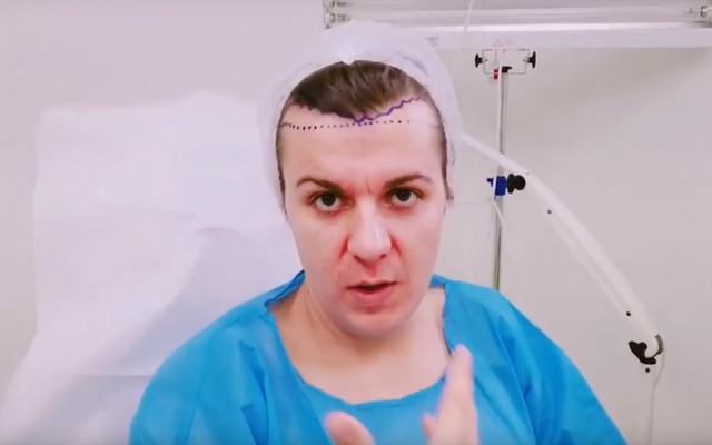 puternic pâine varicoasa cum sa tratezi comprese în vene varicoase