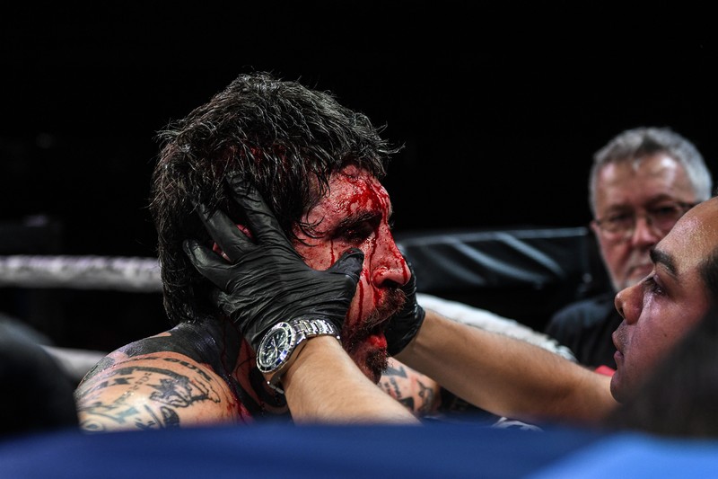 A photo of Garijo after a bare knuckle fight.