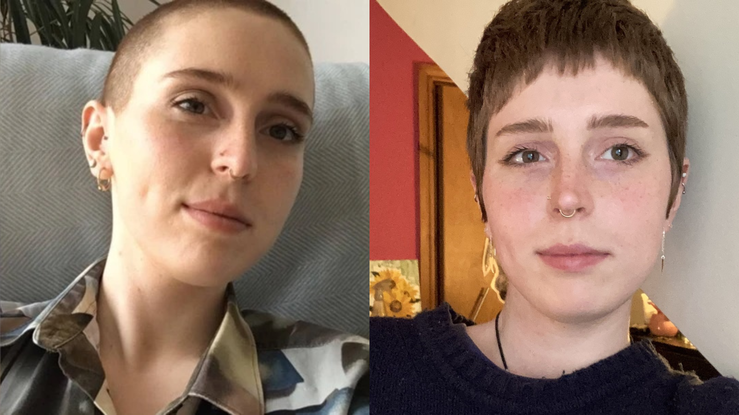Before and After Photos of Women Who Are Growing Out Their Shaved Heads