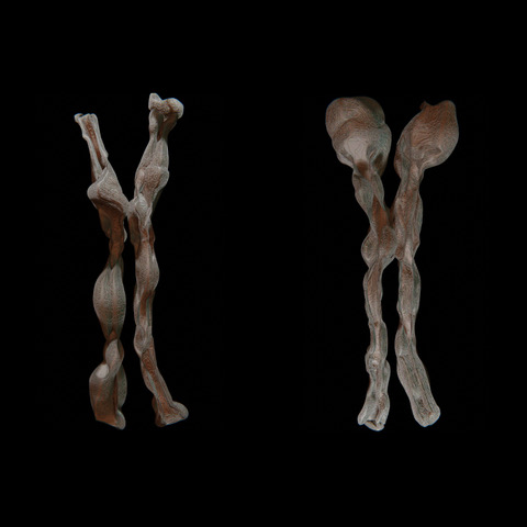Cromosoma X - Sano (left) + Mutato (right) del collettivo Umanesimo Artificiale rehumanusm mostra maxxi roma