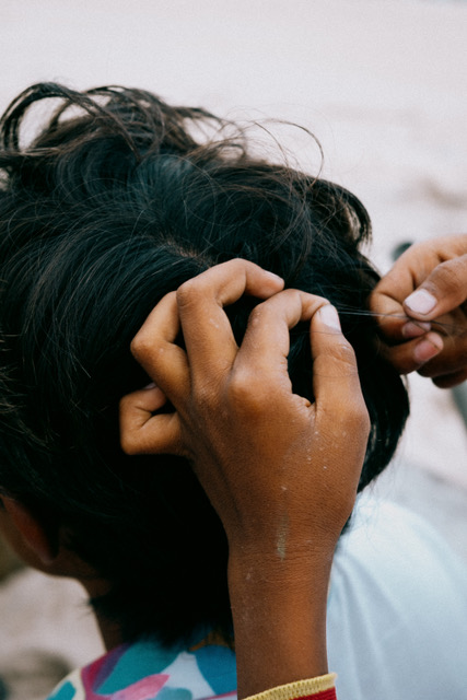 A hair is being plucked out of a boys head.