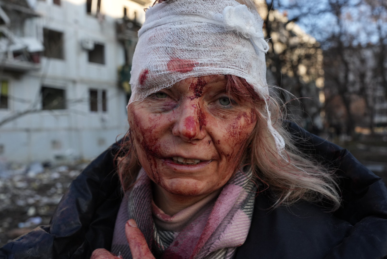 A wounded woman is seen as airstrike damages an apartment complex outside of Kharkiv on Thursday. Photo: Wolfgang Schwan/Anadolu Agency via Getty Images