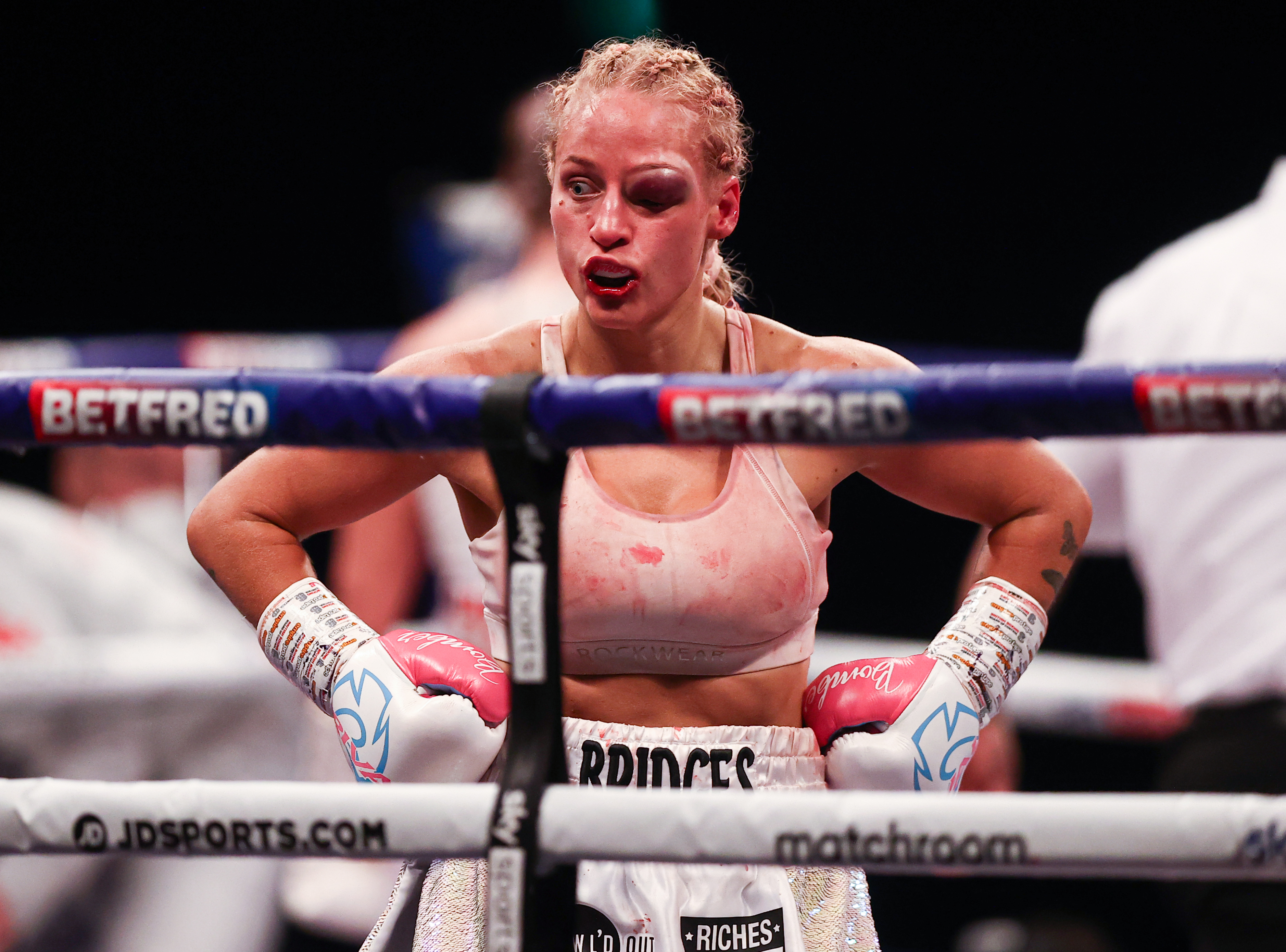 Petinju putri Australia Ebanie Bridges mengalami luka lebam pada mata kirinya akibat kena bogem lawan dalam kejuaraan World Boxing Association. Foto: Richard Pelham