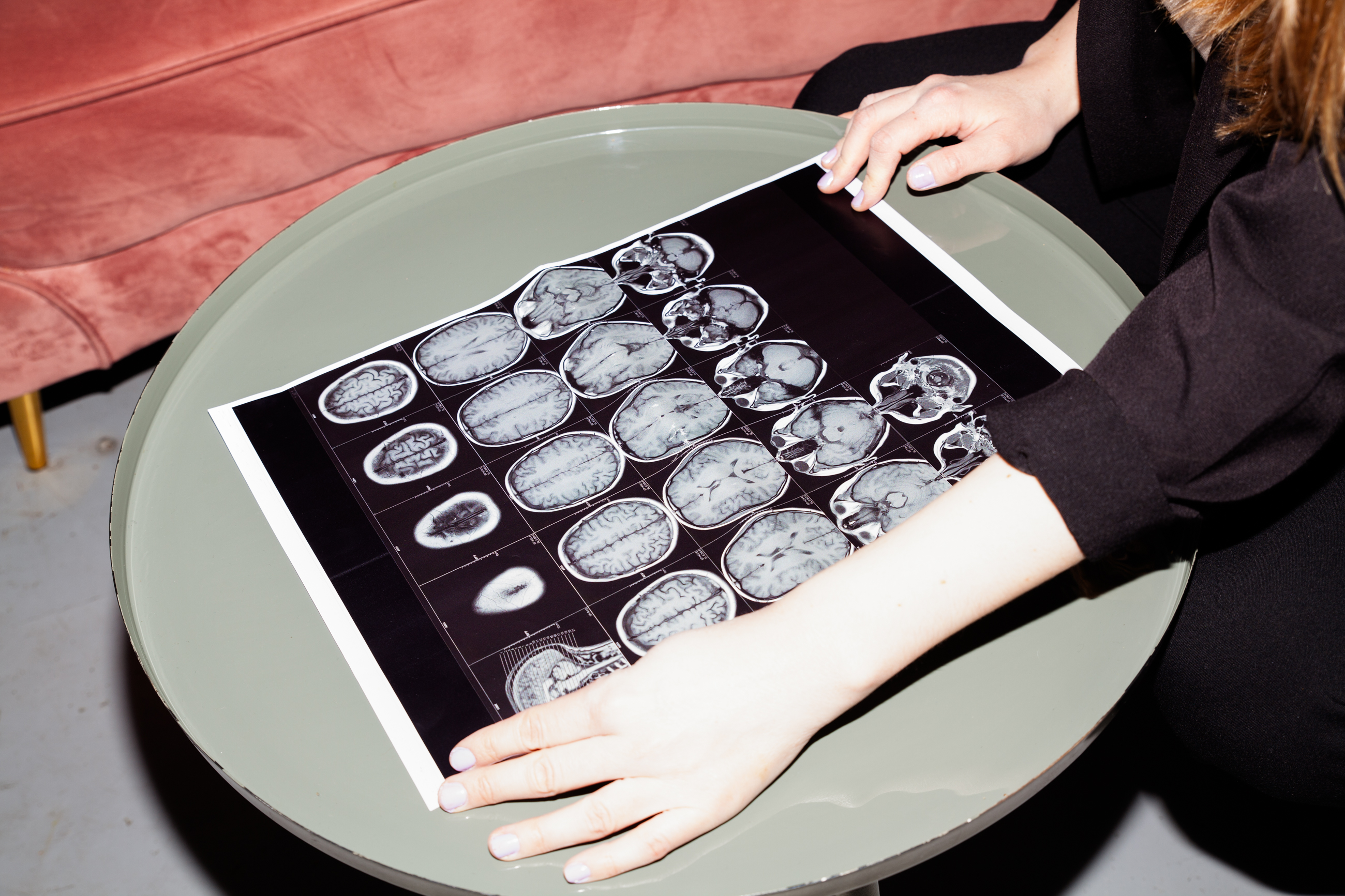 Mo, msninjaaa, Multiple sclerosis – hands holding a picture of an X ray on top of a green coffee table