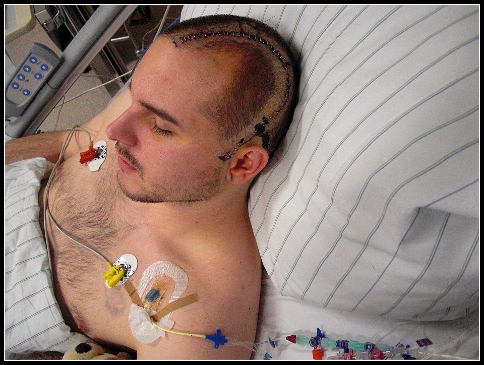 So Ist Es Mit Einem Todlichen Hirntumor Frauen Kennenzulernen