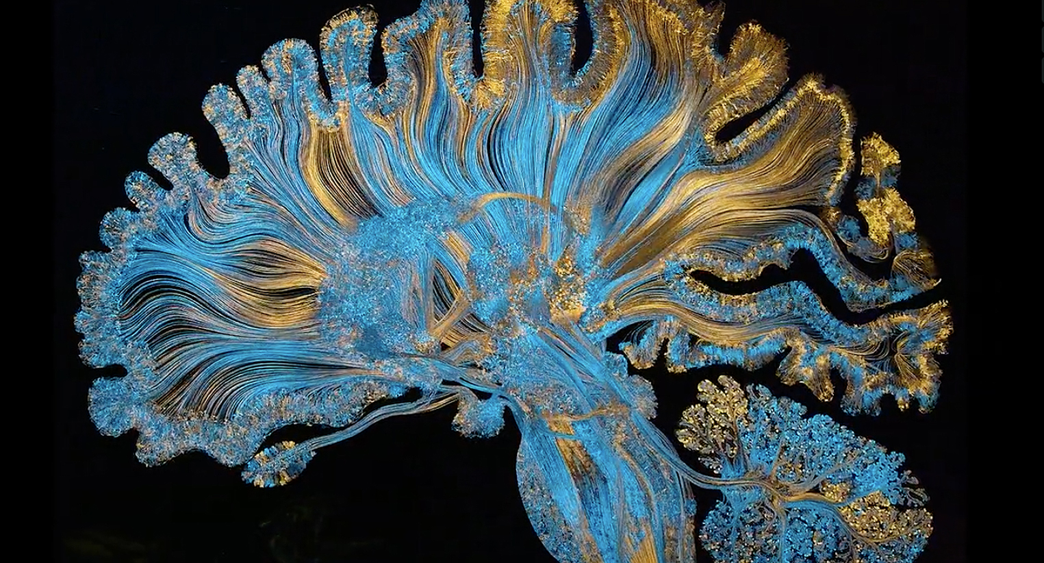 Beautiful Brain Art Uncovers the Complexity of the Human Mind - Creators