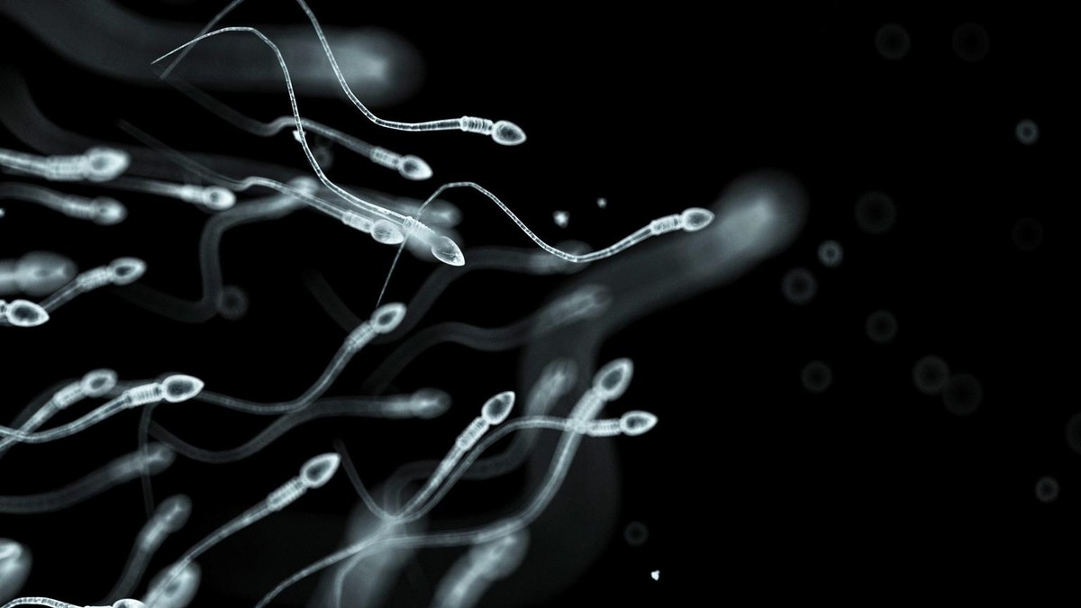 Sperma Braun