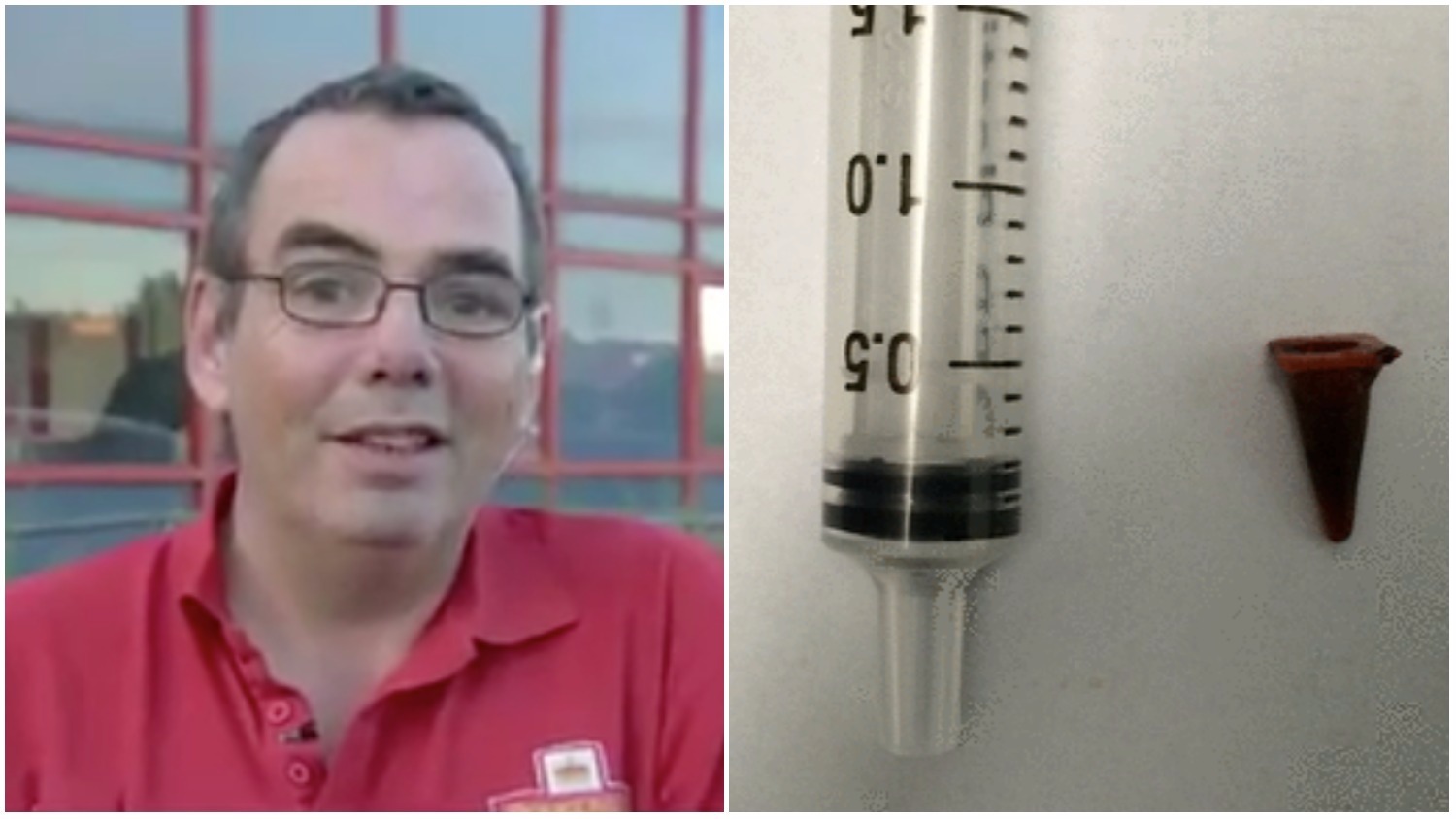 Man's Lung Tumor Scare Was Actually Just a Toy He Inhaled 40 Years Ago