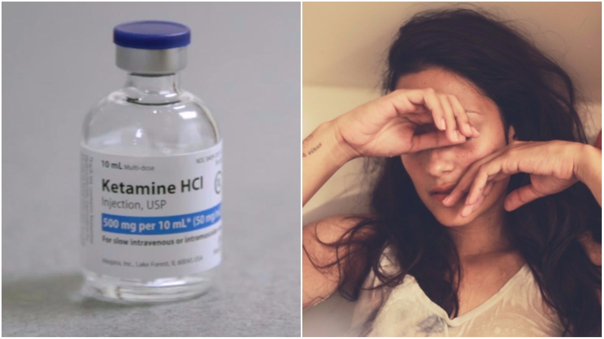 Ketamine Infusions Cut Migraine Pain In Half In New Study