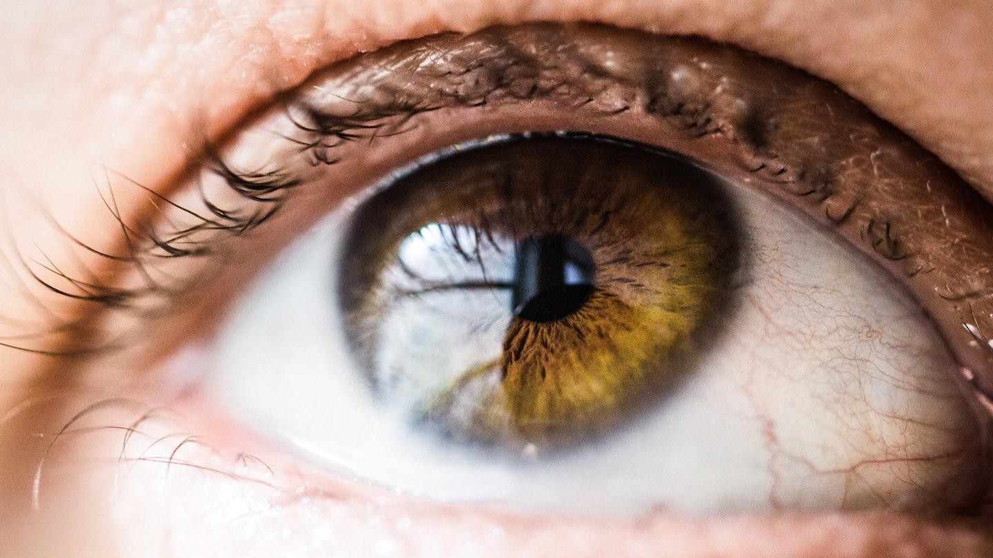 conjuntivitis versus otras infecciones oculares