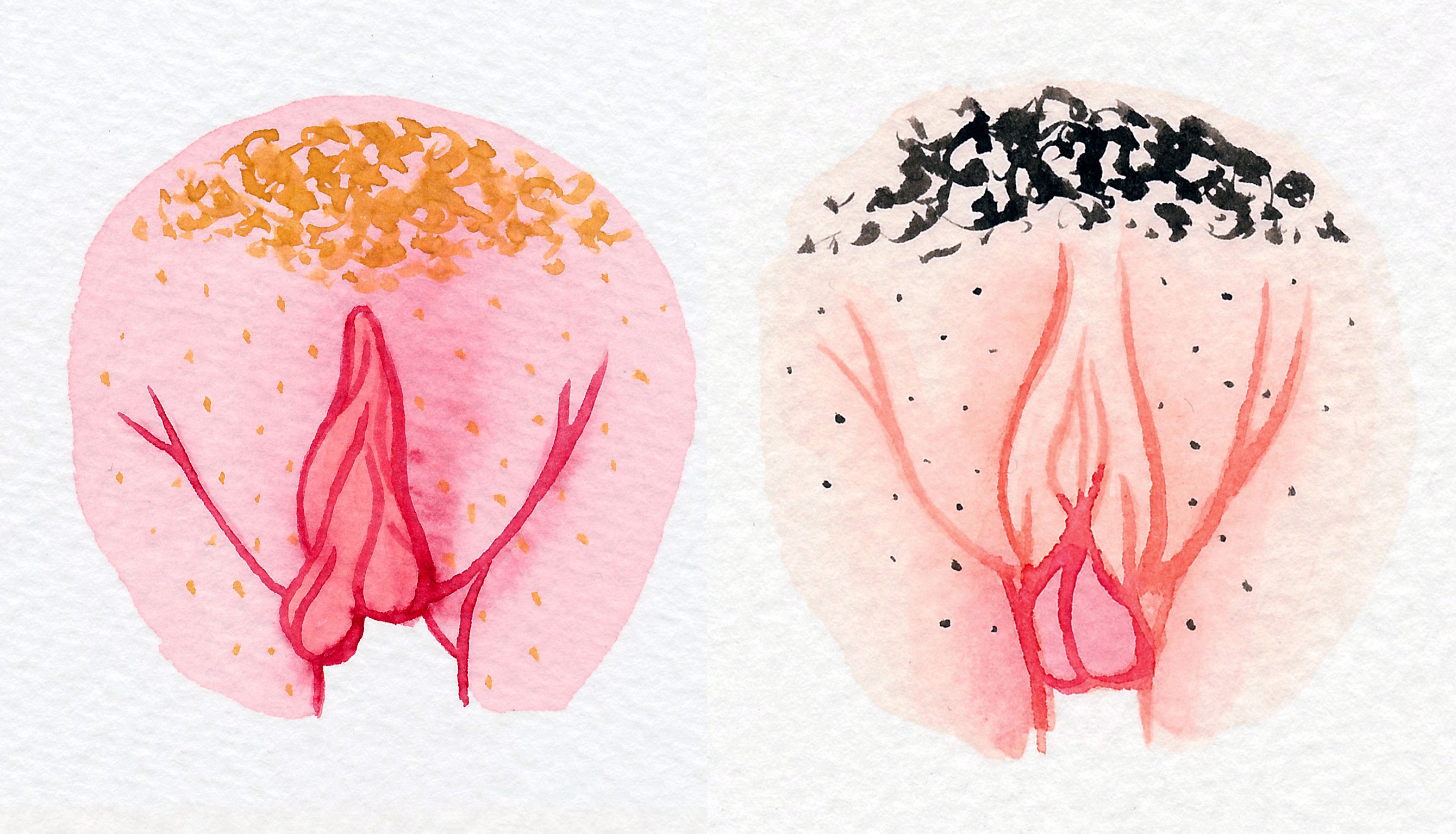 Tipos de vulvas