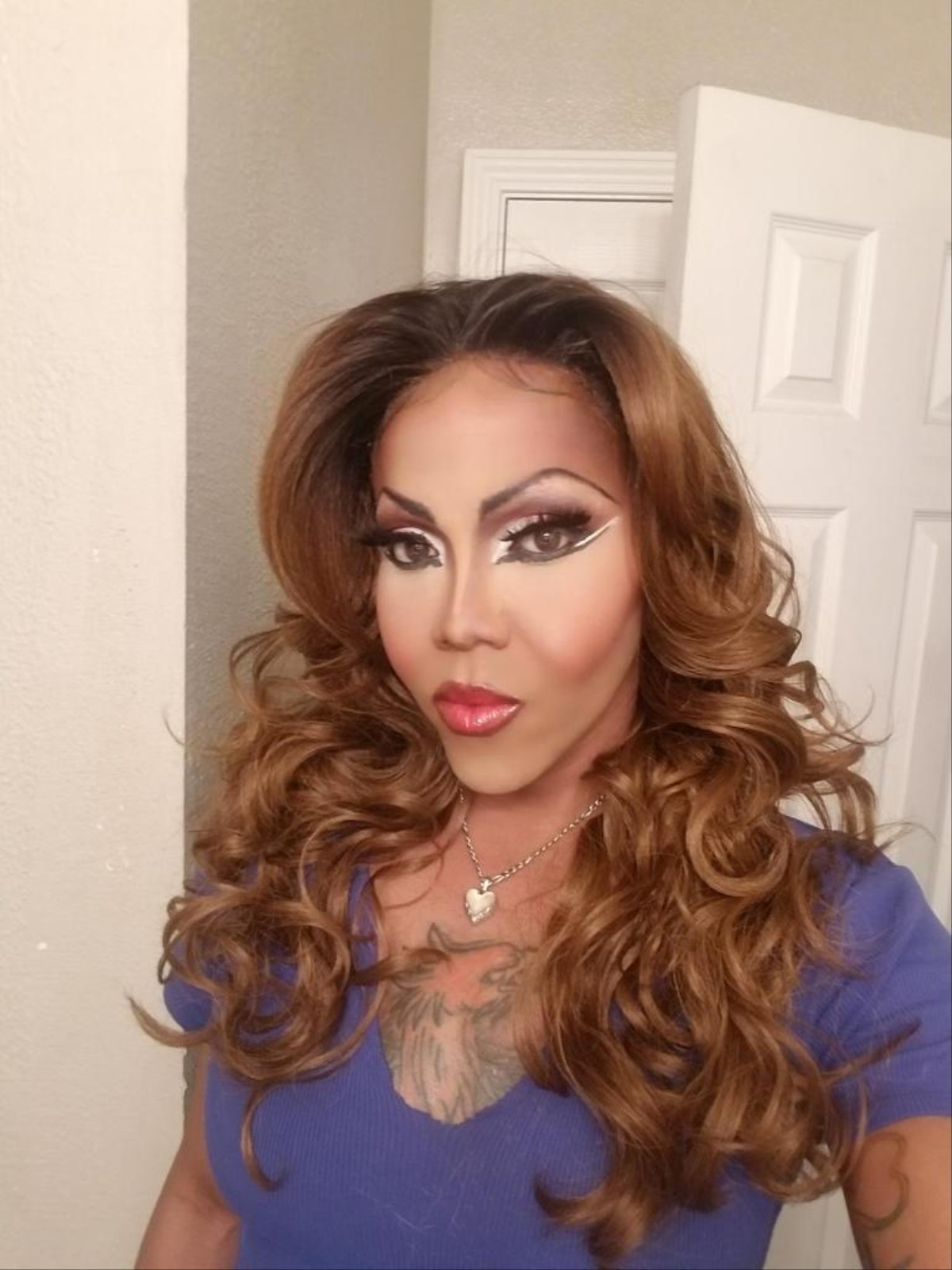 With Limited Health Care Access, Some Trans Women Turn To Silicone