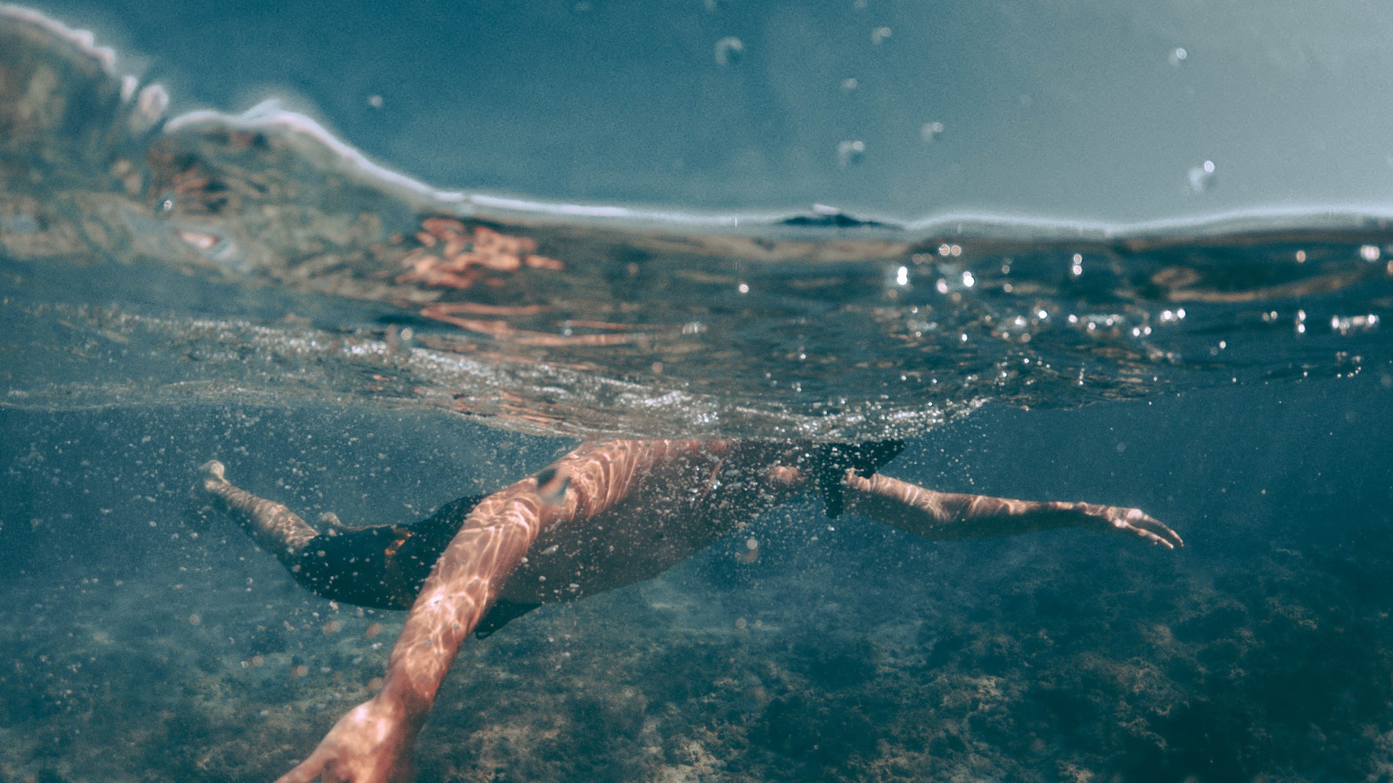 People Are Contracting Flesh Eating Bacteria At The Beach Vice