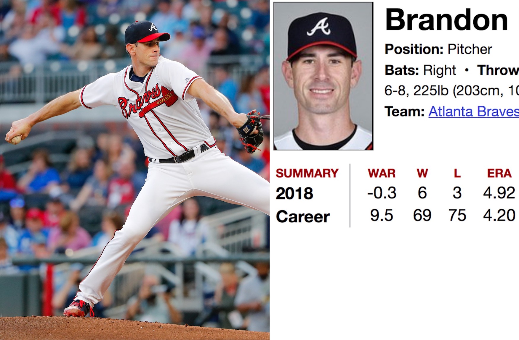 Atlanta Braves pitcher Brandon McCarthy to retire after 2018