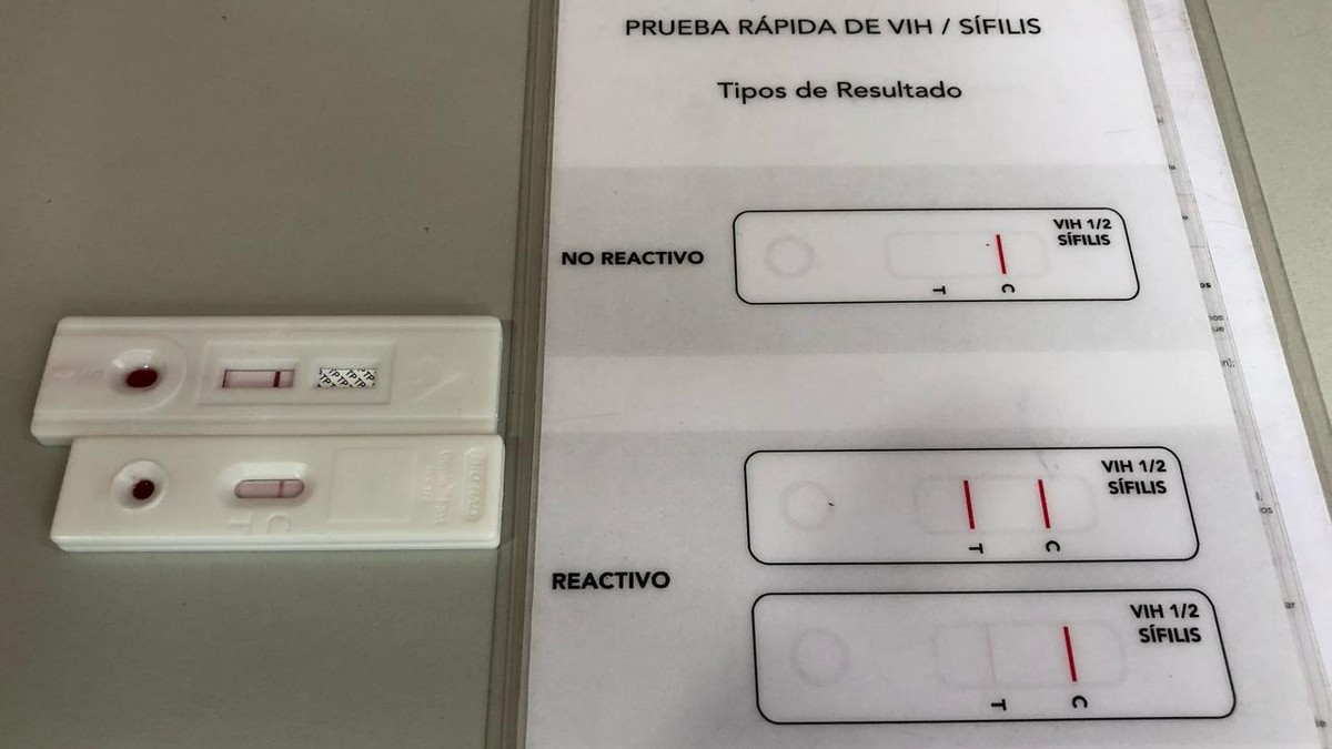 Cómo Saber Si Tienes Vih O Sífilis En La Cdmx En 5 Minutos 