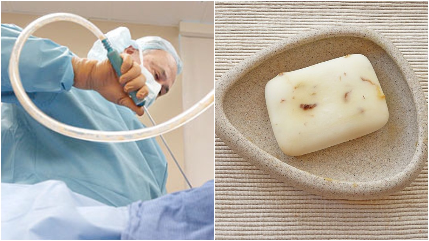 An Artist Is Making Soap from Liposuction Fat