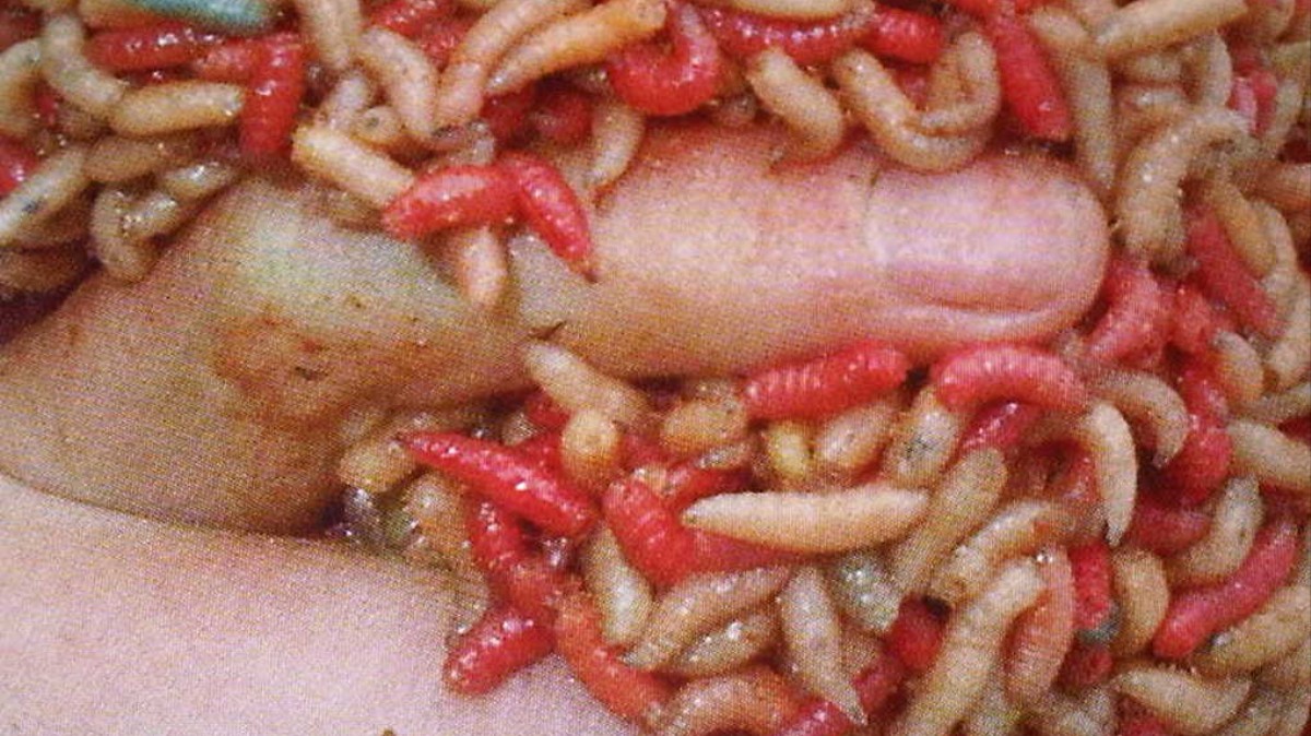 An Aussie Researcher Insists Maggots Are the Best Way to Heal Wounds.
