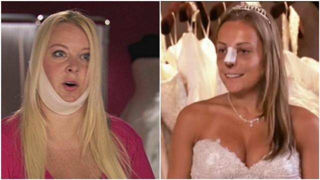 I Was a Contestant on a 2000s-Era Cosmetic Surgery Makeover Show