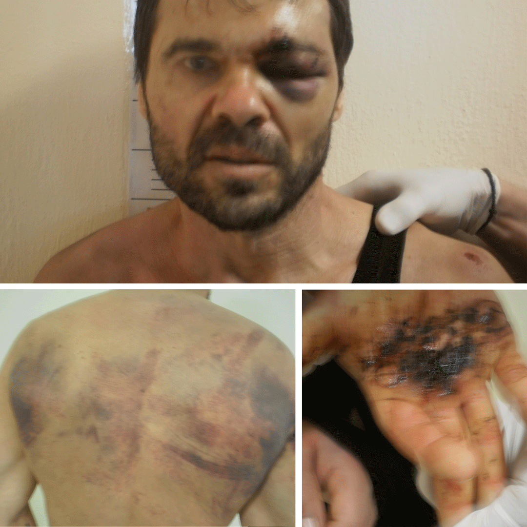 σφιχτό έφηβος μουνί μαύρο κρουνός
