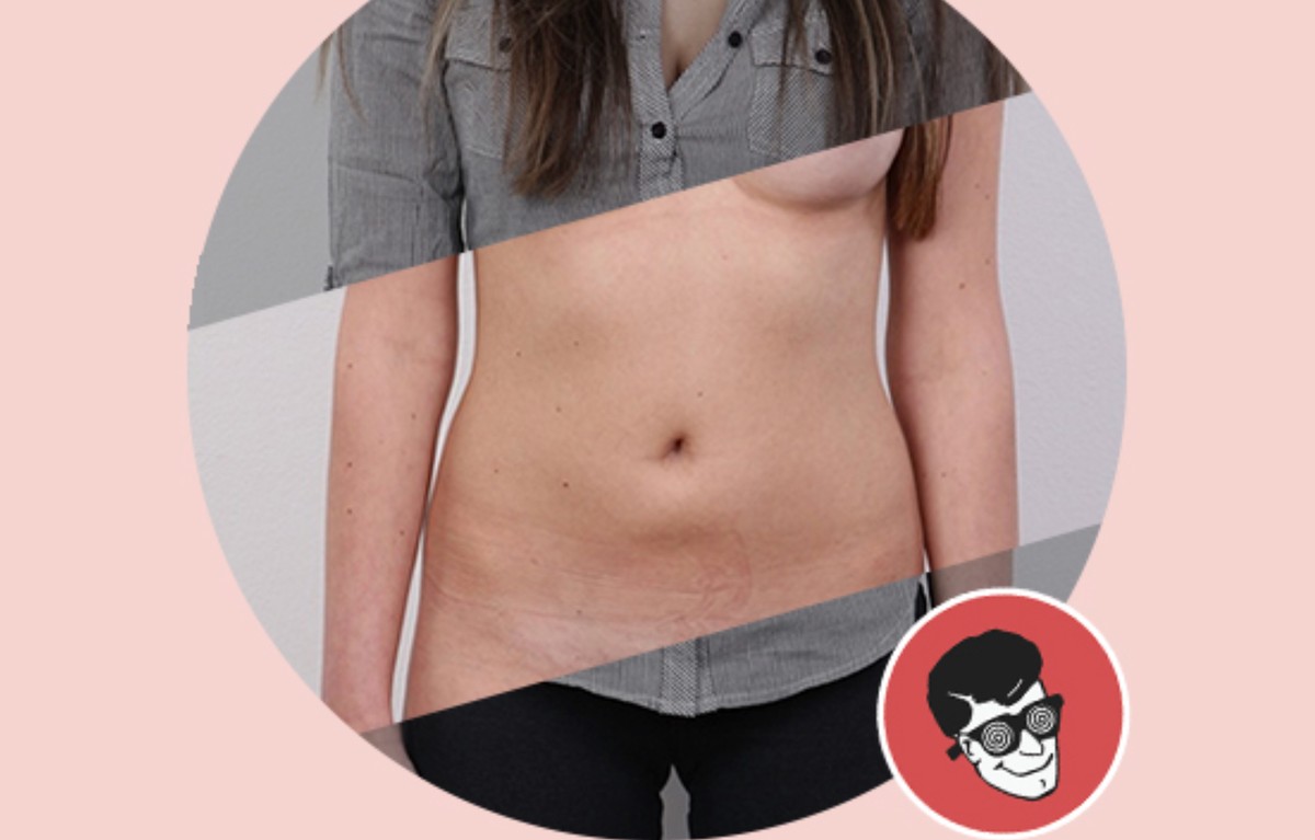 This Horrifying App Undresses a Photo of Any Woman With a ...
