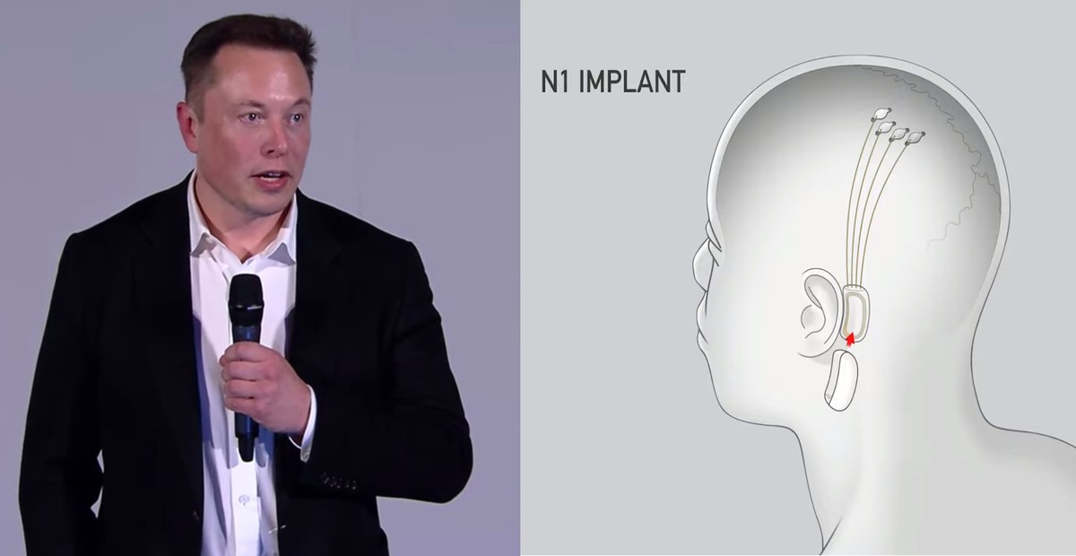 Elon Musk Announces Plan to 'Merge' Human Brains With AI