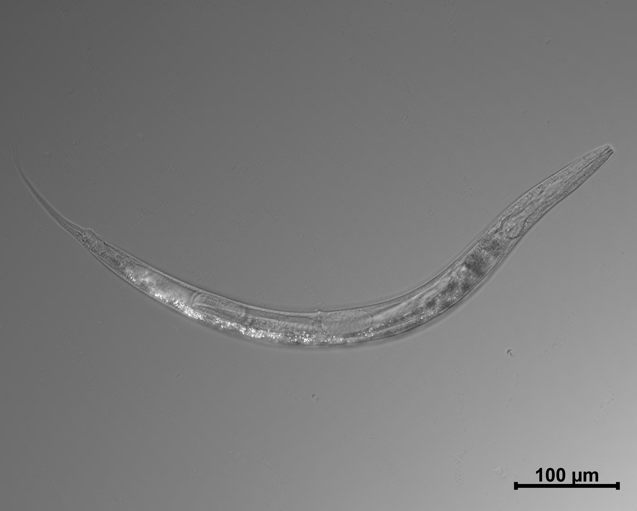 gusanos nematodos en humanos