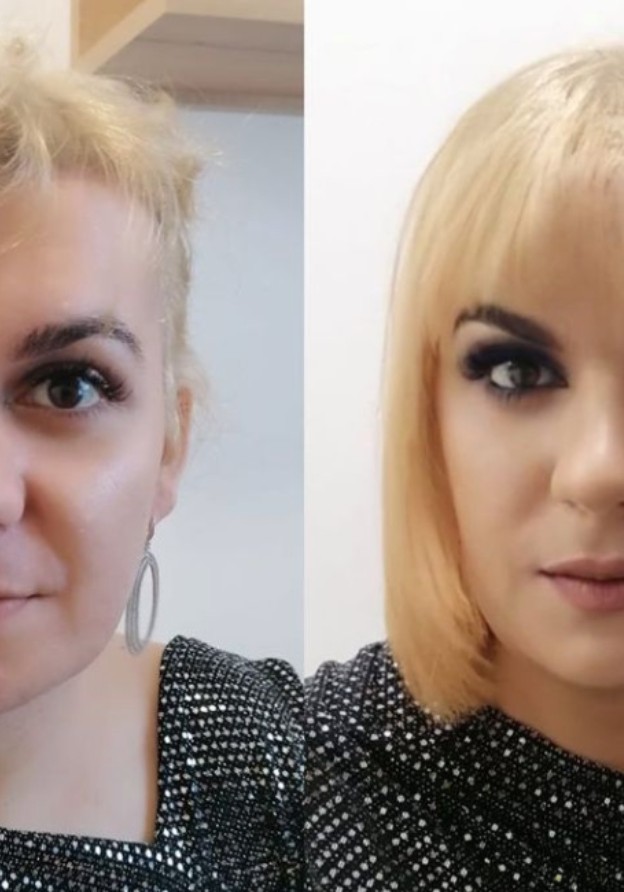 mi am pierdut erecția dacă penisul s a crăpat