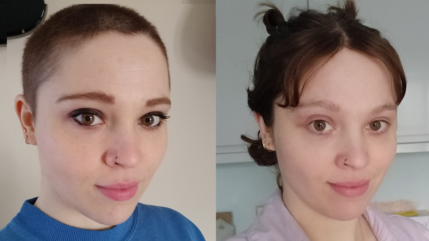 Before and After Photos of Women Who Are Growing Out Their Shaved Heads