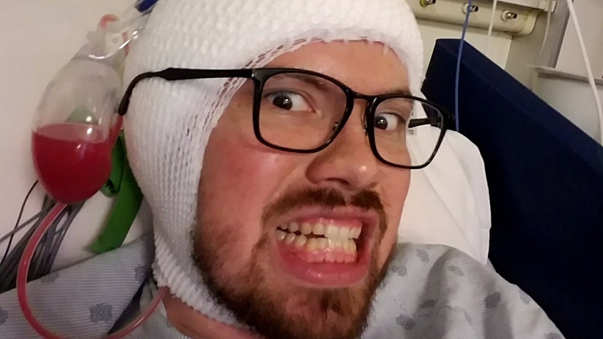 This Guy Had a Piece of His Brain Removed. Now He Cant Feel Fear.