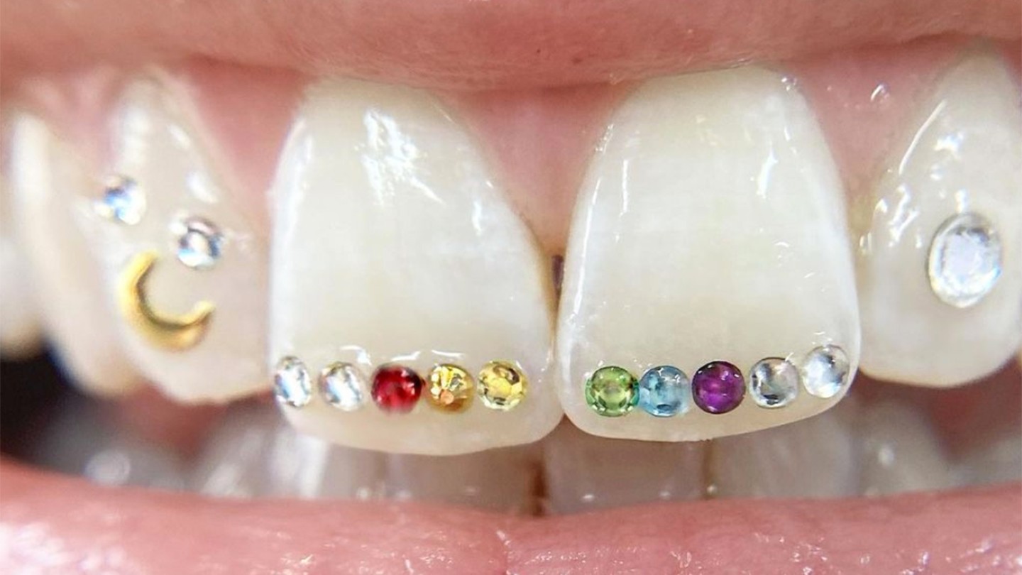 Tooth gems through status and fashion