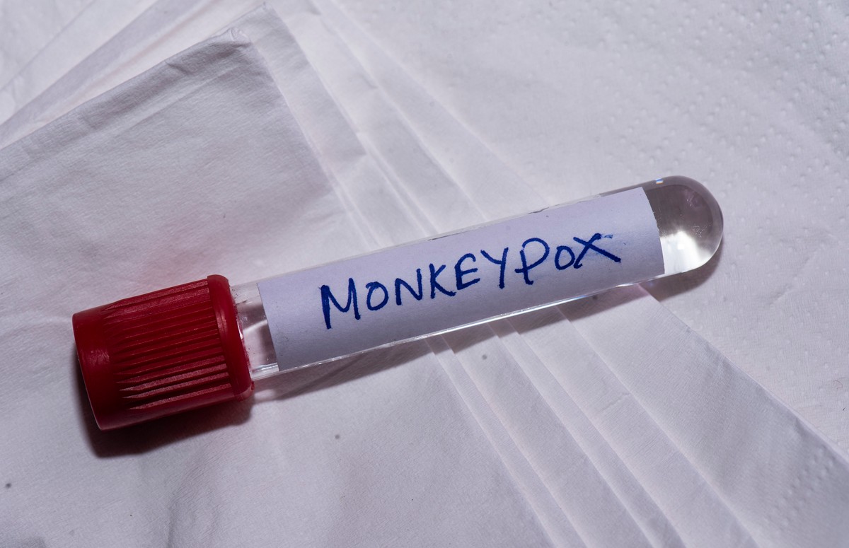 Leaked Videos of Gay Sex Lead to Calls For Monkeypox Contact Tracing in the  Maldives