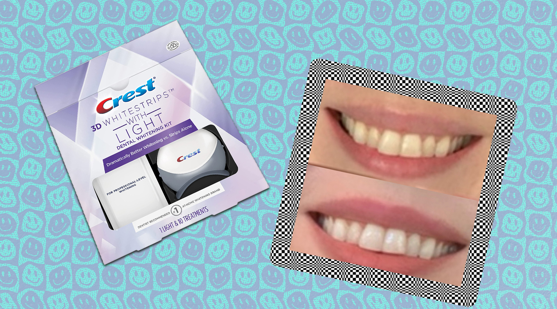 Review The Crest Whitestrips With a Light Work So Well I’m Shook