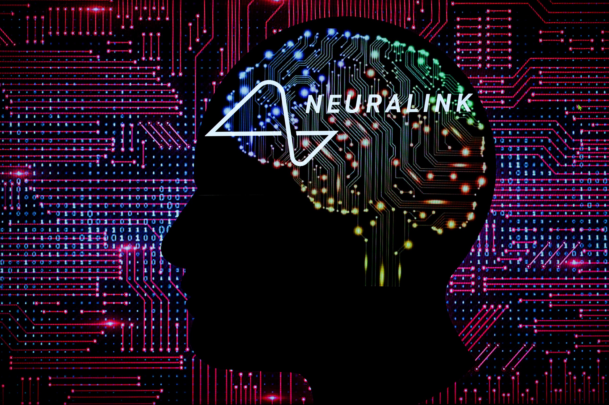 Neuralink Human Trials Set to Proceed, Despite Ethics Concerns