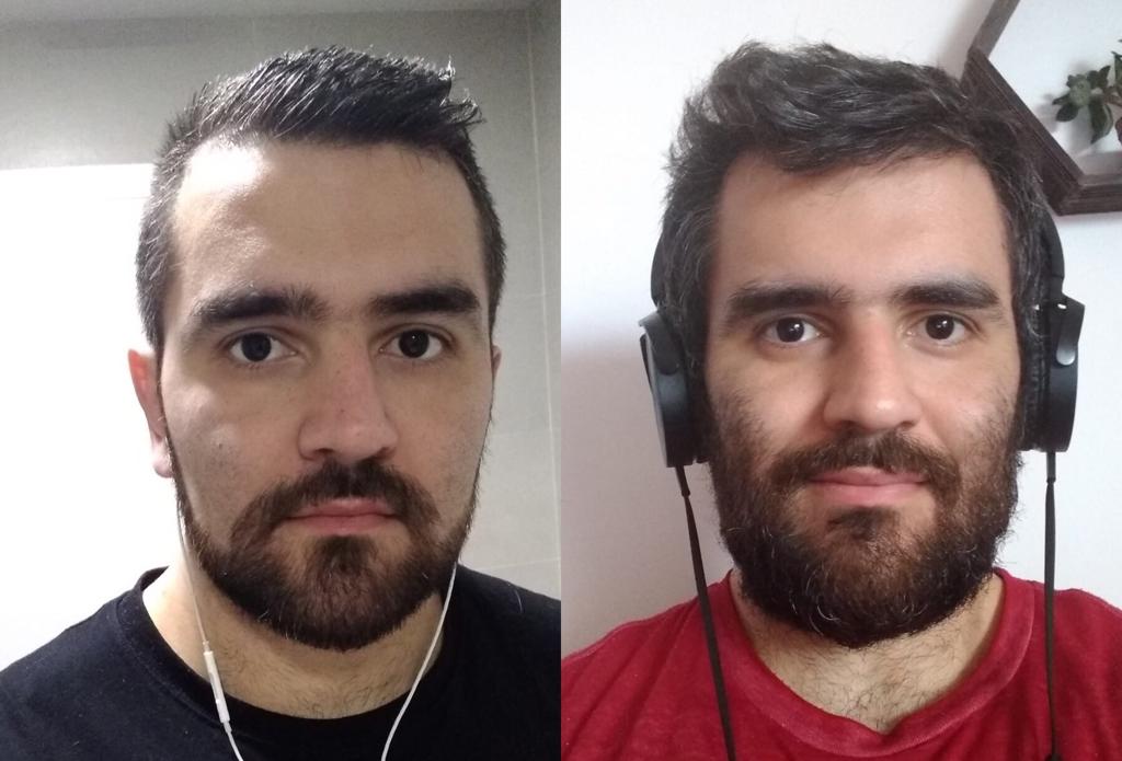 Barba antes y después